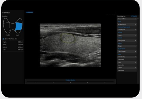 SDETECV5