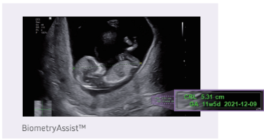 biometryassist-2