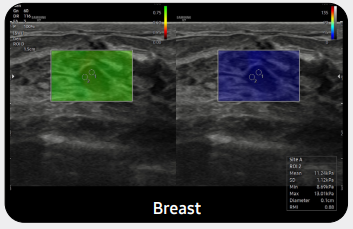 breastv7gi