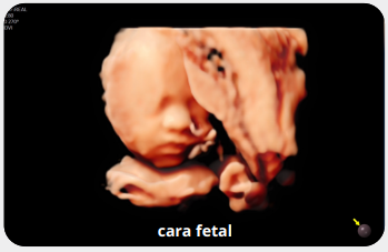 carafetal