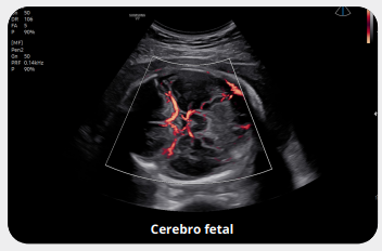 cerebrfetalvisualizar