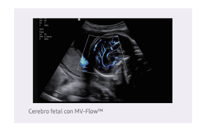 cerebrofetalmvflow