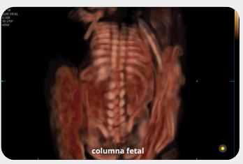 columnafetal