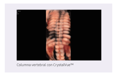 crystalvue