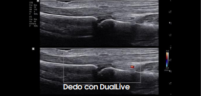 dedodualive