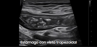 estomagoconvista