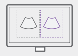 ezcompare