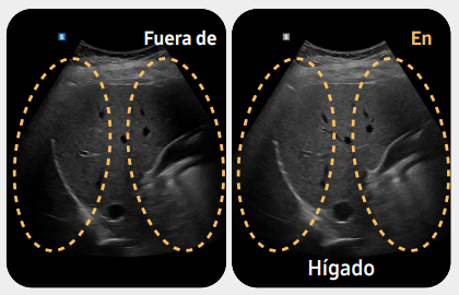 fueradehigado