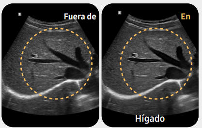 fueradehigado2