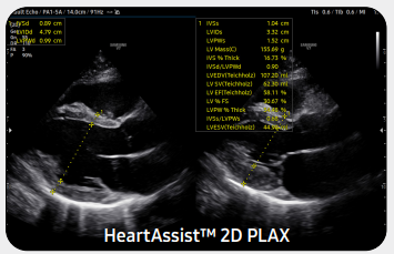 heartAssistv7gi