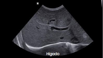 higador20