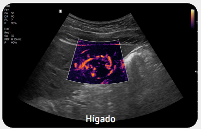 higadov7gi