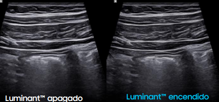 luminantapagado
