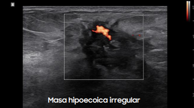 masahipoecoica