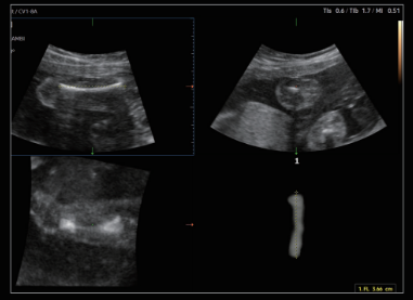 medicionpeso5dlb