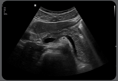 pancreasv7gi