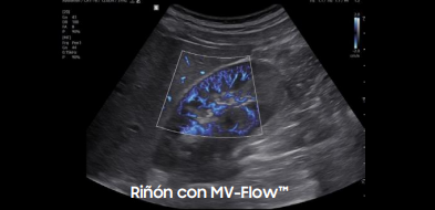 riñonr20