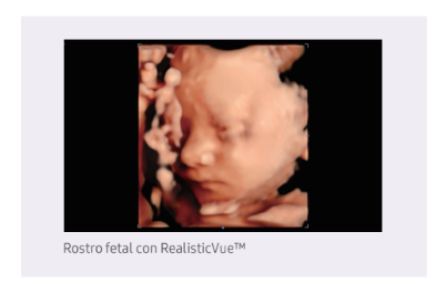 rostrofetalrealistvue