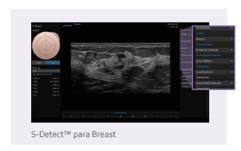sdetectbreast