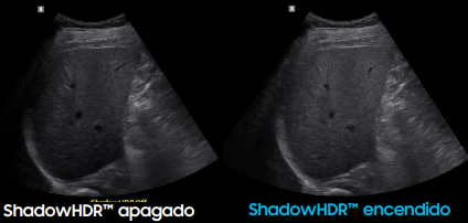 shadowr20