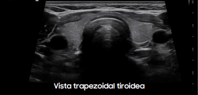 vistatrapezoidal